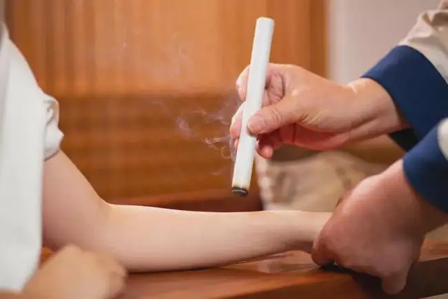 艾灸和拔罐的注意事項！